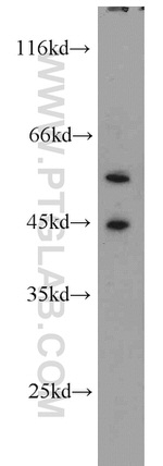 RBMS2 Antibody in Western Blot (WB)