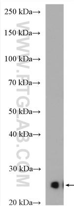 CIDEA Antibody in Western Blot (WB)
