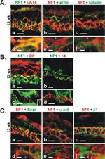 E-cadherin Antibody in Immunohistochemistry (IHC)