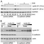 E-cadherin Antibody in Western Blot (WB)