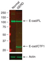 E-cadherin Antibody in Western Blot (WB)
