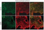 E-cadherin Antibody in Immunohistochemistry (IHC)