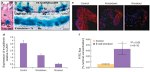 E-cadherin Antibody in Immunohistochemistry (IHC)