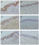 E-cadherin Antibody in Immunohistochemistry (IHC)
