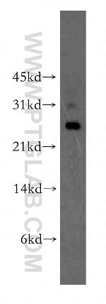 UBTD2 Antibody in Western Blot (WB)