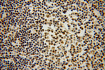 DNAJB1 Antibody in Immunohistochemistry (Paraffin) (IHC (P))