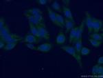 APBB2 Antibody in Immunocytochemistry (ICC/IF)