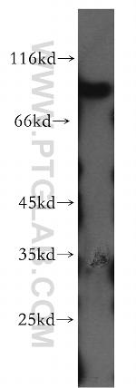 APBB2 Antibody in Western Blot (WB)
