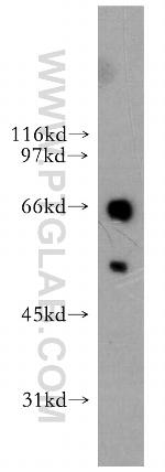 ETV6 Antibody in Western Blot (WB)