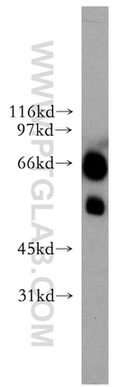 ETV6 Antibody in Western Blot (WB)