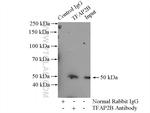 TFAP2B Antibody in Immunoprecipitation (IP)