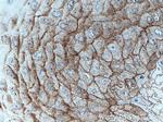 CDSN Antibody in Immunohistochemistry (Paraffin) (IHC (P))