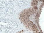 CDSN Antibody in Immunohistochemistry (Paraffin) (IHC (P))