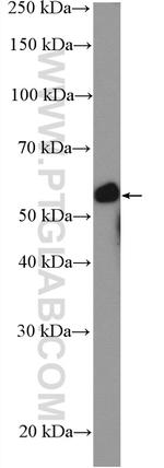 CDSN Antibody in Western Blot (WB)