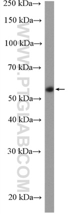 CDSN Antibody in Western Blot (WB)