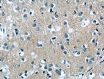 Neurochondrin Antibody in Immunohistochemistry (Paraffin) (IHC (P))