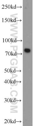 Neurochondrin Antibody in Western Blot (WB)