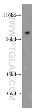 Neurochondrin Antibody in Western Blot (WB)