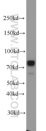 Neurochondrin Antibody in Western Blot (WB)