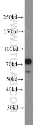 Neurochondrin Antibody in Western Blot (WB)