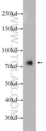 Neurochondrin Antibody in Western Blot (WB)