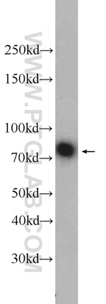 Neurochondrin Antibody in Western Blot (WB)
