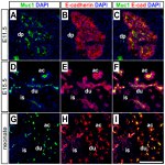 E-cadherin Antibody in Immunohistochemistry (Frozen) (IHC (F))