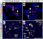 E-cadherin Antibody in Immunohistochemistry (Frozen) (IHC (F))