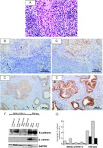 E-cadherin Antibody in Western Blot, Immunohistochemistry (Paraffin) (WB, IHC (P))