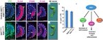 E-cadherin Antibody in Immunohistochemistry (Paraffin) (IHC (P))