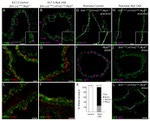 E-cadherin Antibody in Immunohistochemistry (Frozen) (IHC (F))