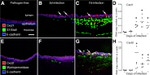 E-cadherin Antibody in Immunohistochemistry (IHC)
