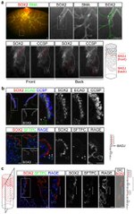 E-cadherin Antibody in Immunohistochemistry (IHC)