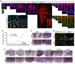 E-cadherin Antibody in Immunohistochemistry (IHC)