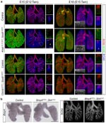 E-cadherin Antibody in Immunohistochemistry (IHC)