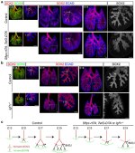 E-cadherin Antibody in Immunohistochemistry (IHC)