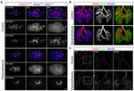 E-cadherin Antibody in Immunohistochemistry (IHC)