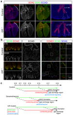 E-cadherin Antibody in Immunohistochemistry (IHC)