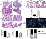 E-cadherin Antibody in Immunohistochemistry (Frozen) (IHC (F))
