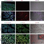E-cadherin Antibody in Immunohistochemistry (IHC)