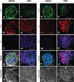 E-cadherin Antibody in Immunohistochemistry (IHC)