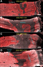 E-cadherin Antibody in Immunohistochemistry (Paraffin) (IHC (P))