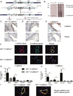 E-cadherin Antibody in Immunohistochemistry (IHC)