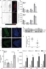 E-cadherin Antibody in Immunohistochemistry (Paraffin) (IHC (P))