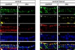 E-cadherin Antibody in Immunohistochemistry (IHC)