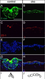 ZO-1 Antibody in Immunohistochemistry (IHC)