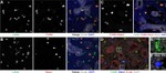 E-cadherin Antibody in Immunohistochemistry (Frozen) (IHC (F))