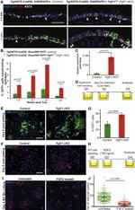 E-cadherin Antibody in Immunohistochemistry (IHC)