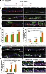 E-cadherin Antibody in Immunohistochemistry (IHC)
