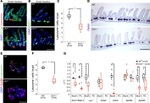 E-cadherin Antibody in Immunohistochemistry (IHC)